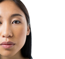 Ethnic Rhinoplasty:  Female face, front view