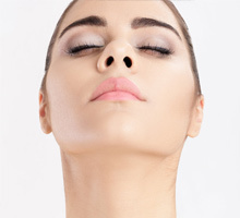 Revision Rhinoplasty: Female face, front view