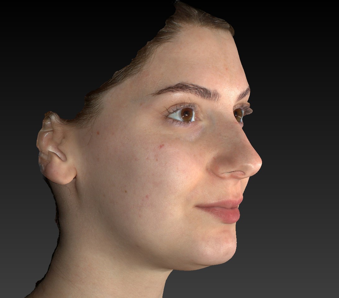 Modern Anaesthesia - 3d model face