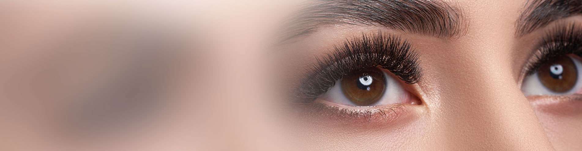 BEFORE & AFTER GALLERY Eyelid Surgery