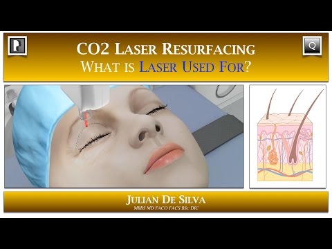 Watch Video: Skin & Laser Question- How can CO2 Laser Skin Resurfacing benefit me?