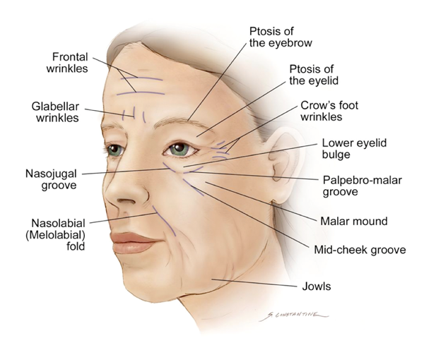 Scheme wrinkles on the face