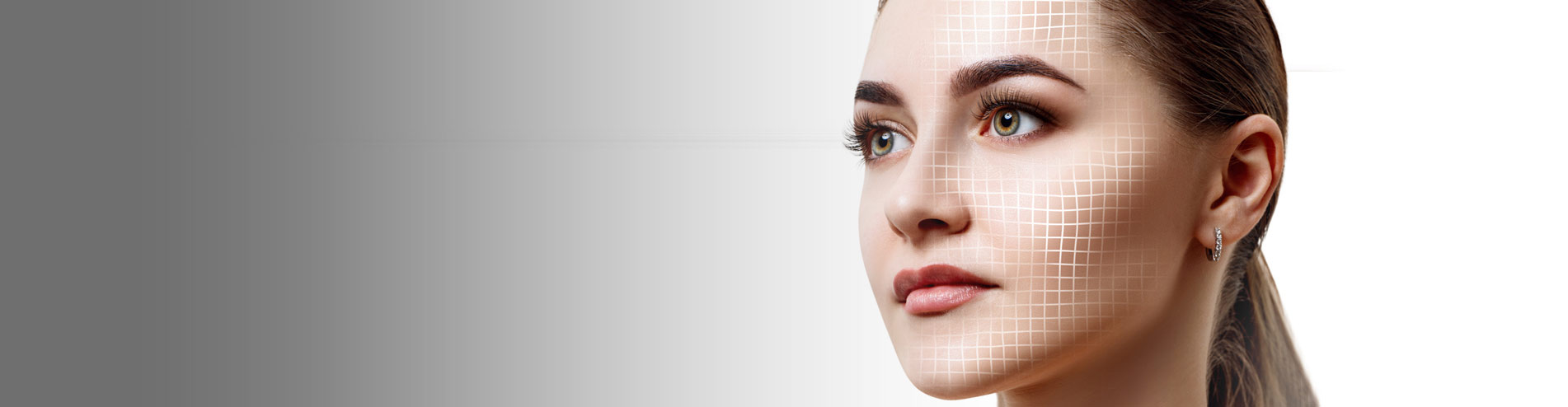 Before and After: Facelift & Neck Lift