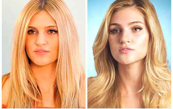 Celebrity Surgery: Zooey Deschanel - before and after treatment photos