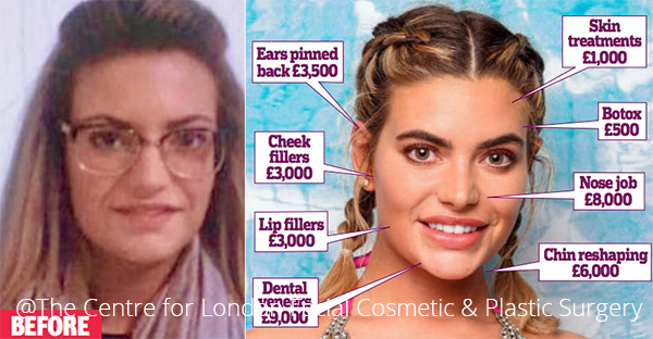 Megan Barton (treatment procedures with face)