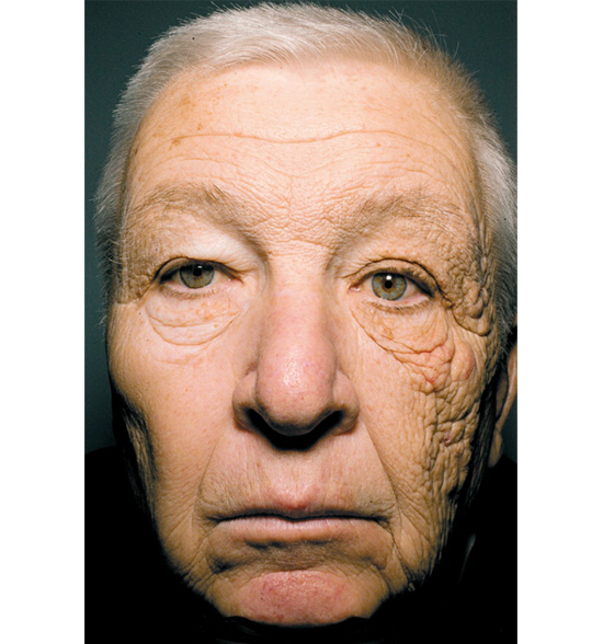 Skin Protection: Basic skincare - Cleansing, Toning, Moisturizing, Protecting (Photo: Truck Drivers Face)