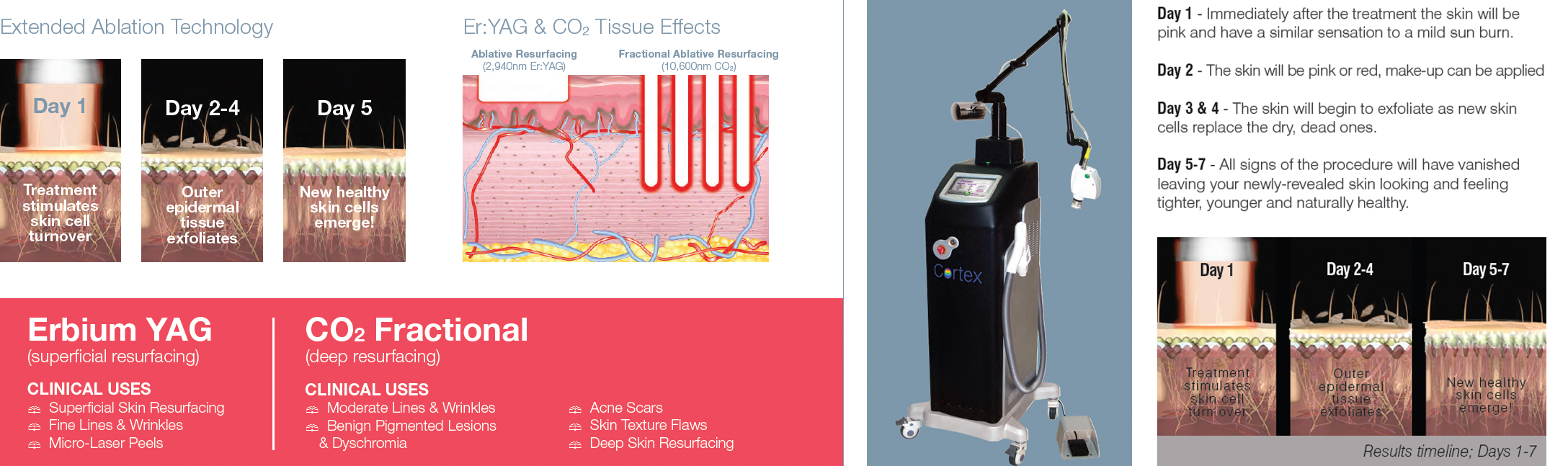 State of The Art Laser Technology