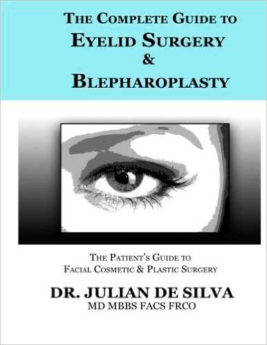 The Complete Guide to Eyelid Surgery and Blepharoplasty - Dr.Julian De Silva