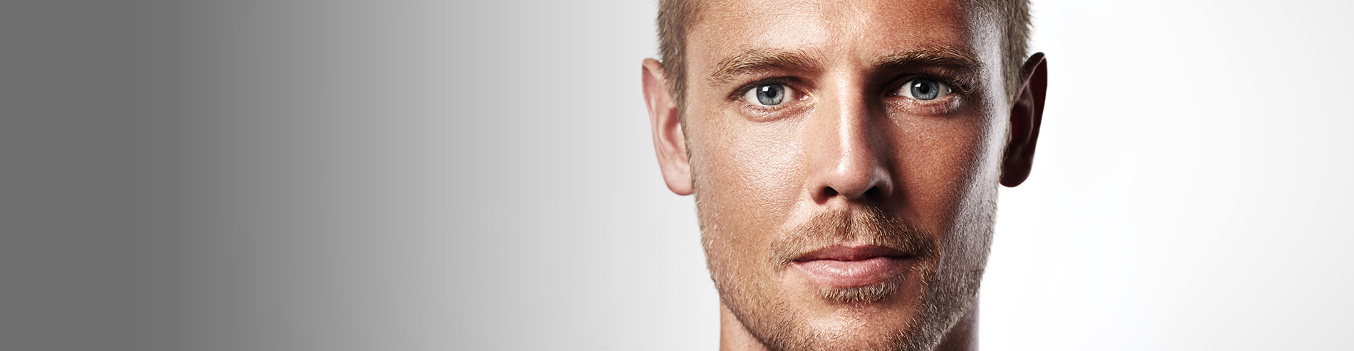 Before and After: Male Blepharoplasty