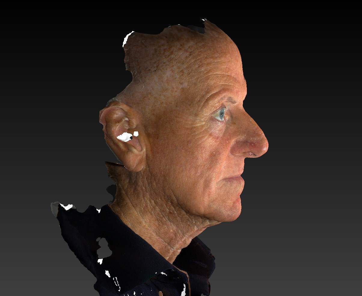 3d model Male face, Facelift & Neck Lift Treatment, right side view,