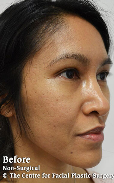 Non-Surgical Treatments Before 1