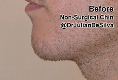 Non-Surgical Treatments Before 2