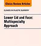 Publications: Dr De Silva’ Book Chapter on complex eyelid surgery published in Clinics in Plastic Surgery (Elsevier 2015).