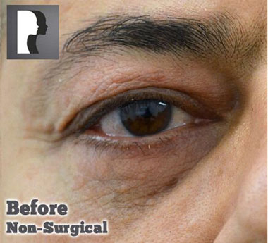 Non-Surgical Treatments Before 5