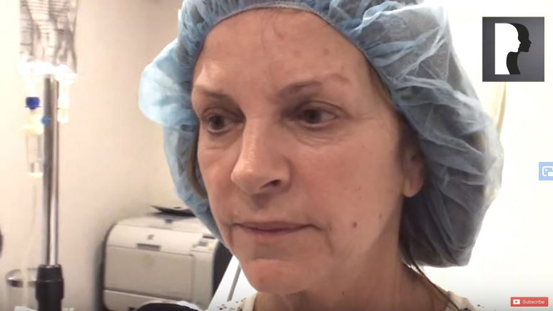 Video Diaries: Face and Neck Lift