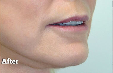 Non-Surgical Treatments After 8