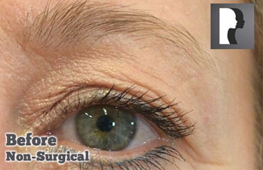 Non-Surgical Treatments Before 9