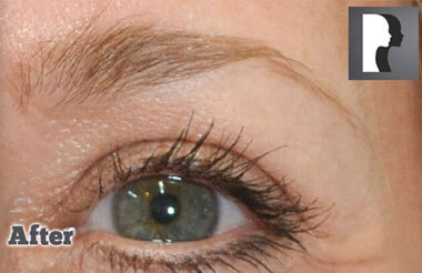 Non-Surgical Treatments After 9