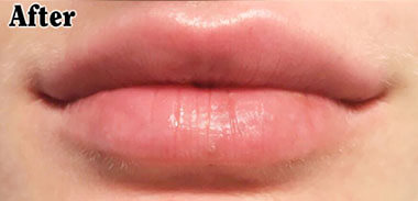 Non-Surgical Treatments After 3