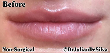 Non-Surgical Treatments Before 3