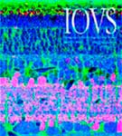 Publications: Journal of Investigative Ophthalmology and Visual Science