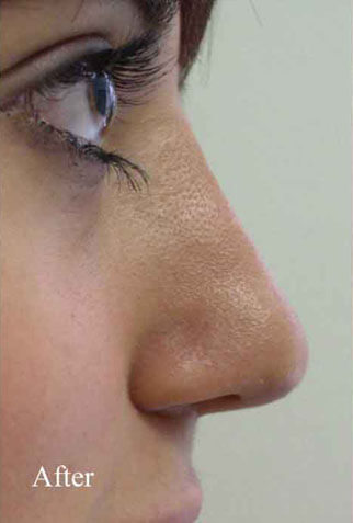 Non-Surgical Treatments After 6