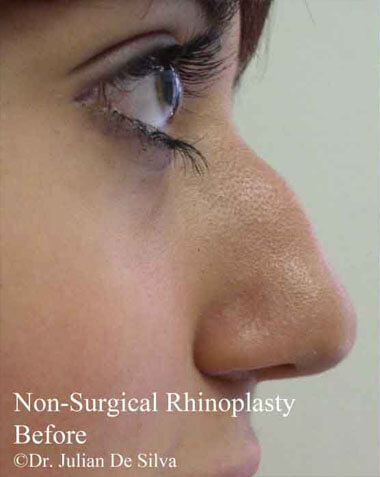 Non-Surgical Treatments Before 6