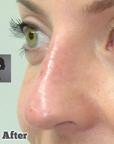 Non-Surgical Treatments After 7