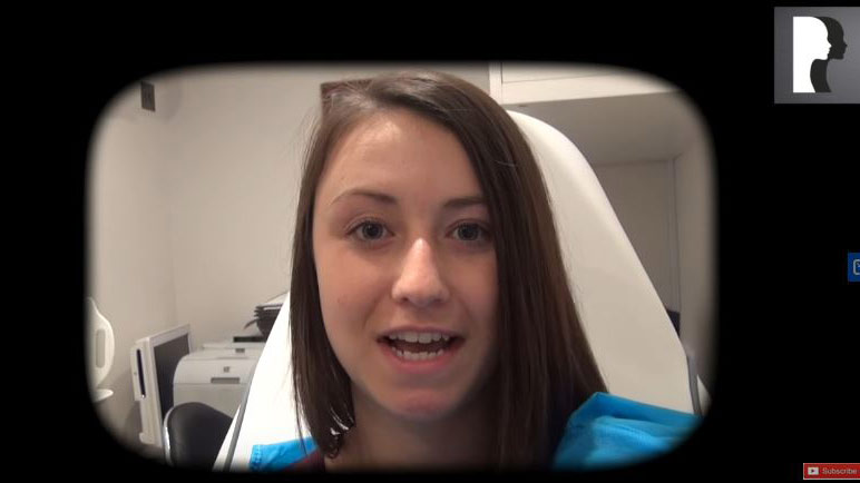 Video Diaries: woman in her 20s underwent Rhinoplasty with septoplasty under Sedation Anaesthesia