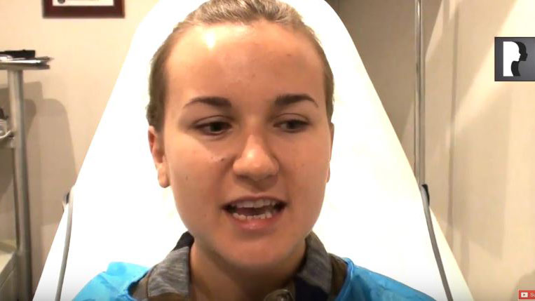 Video Diaries: of patient who underwent Rhinoplasty & Septoplasty