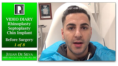 Rhinoplasty & Chin Implant Video Diary (VD18)