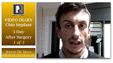 Chin Implant Video Diary (CVD1)