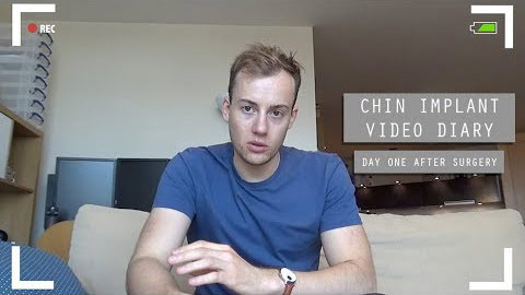 Chin Implant Sept 2019