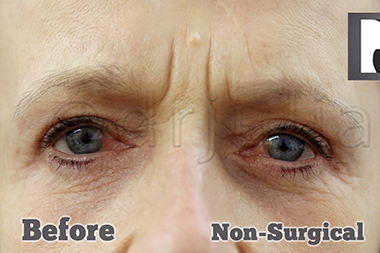 Non-Surgical Treatments Before 12