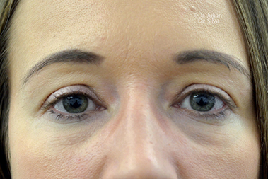 Non-Surgical Treatments Before 15