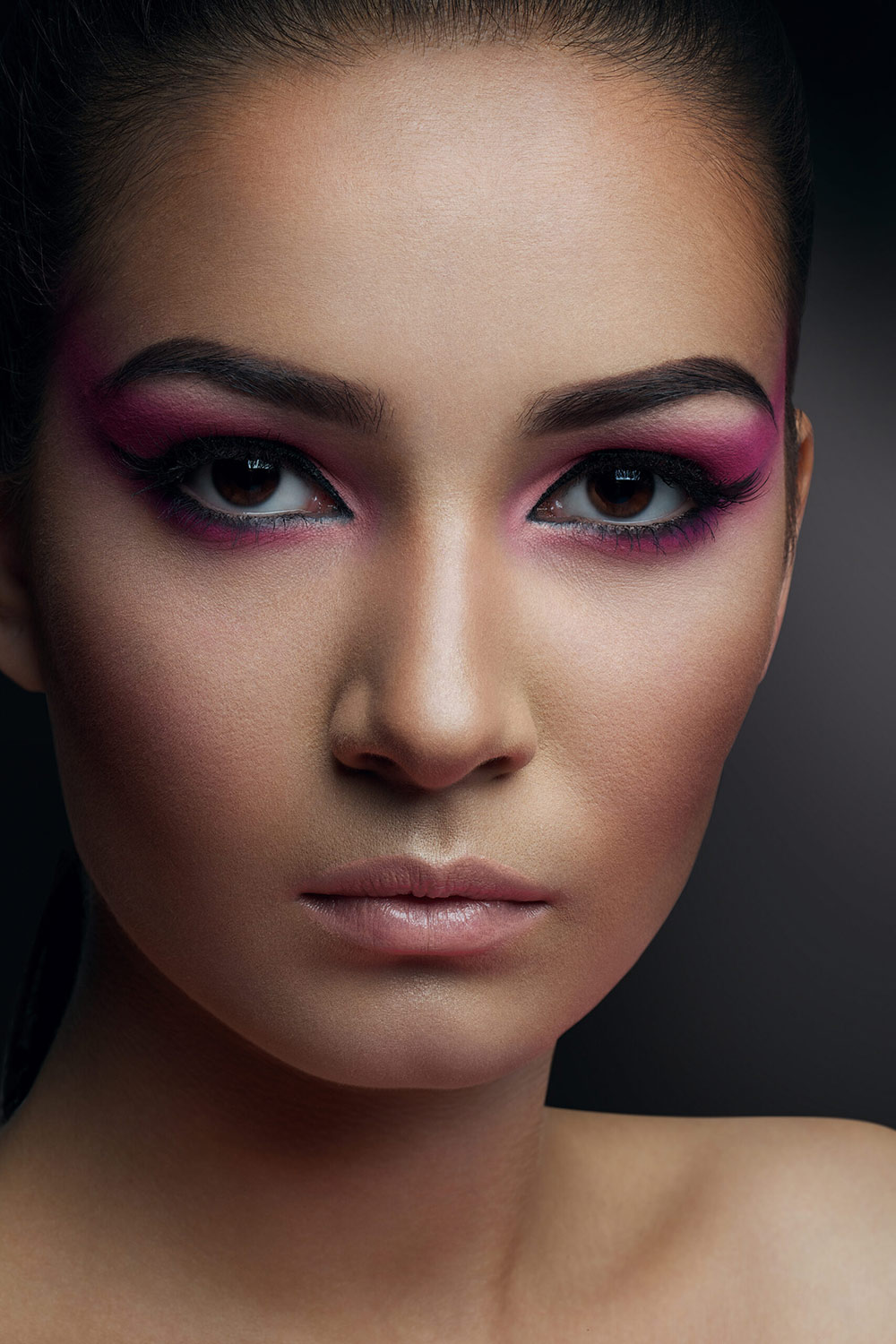 Revision Rhinoplasty