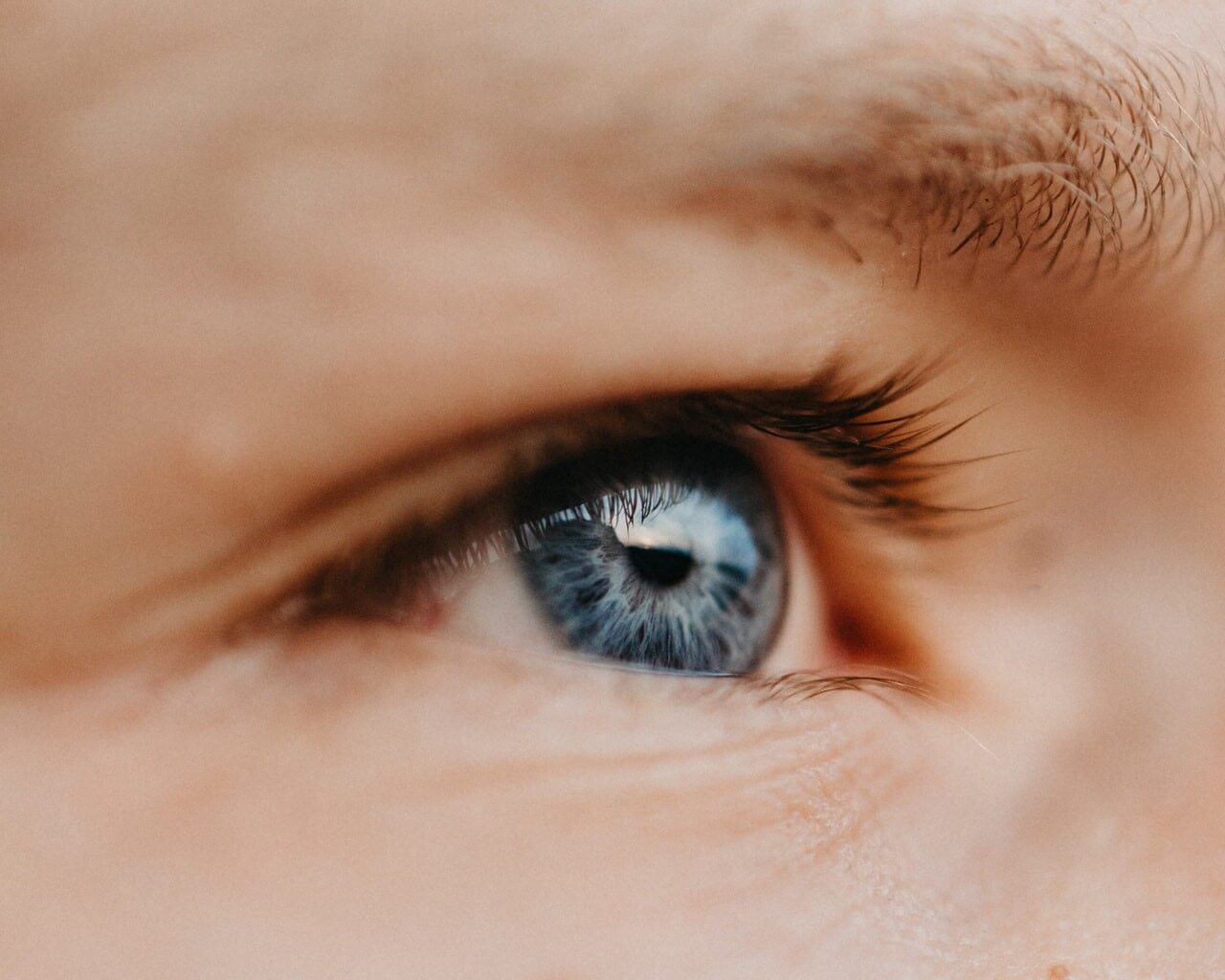 Crow’s Feet Around The Eyes