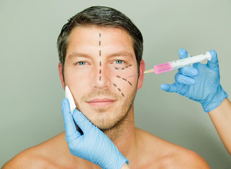 Male face - Deep Plane Facelift