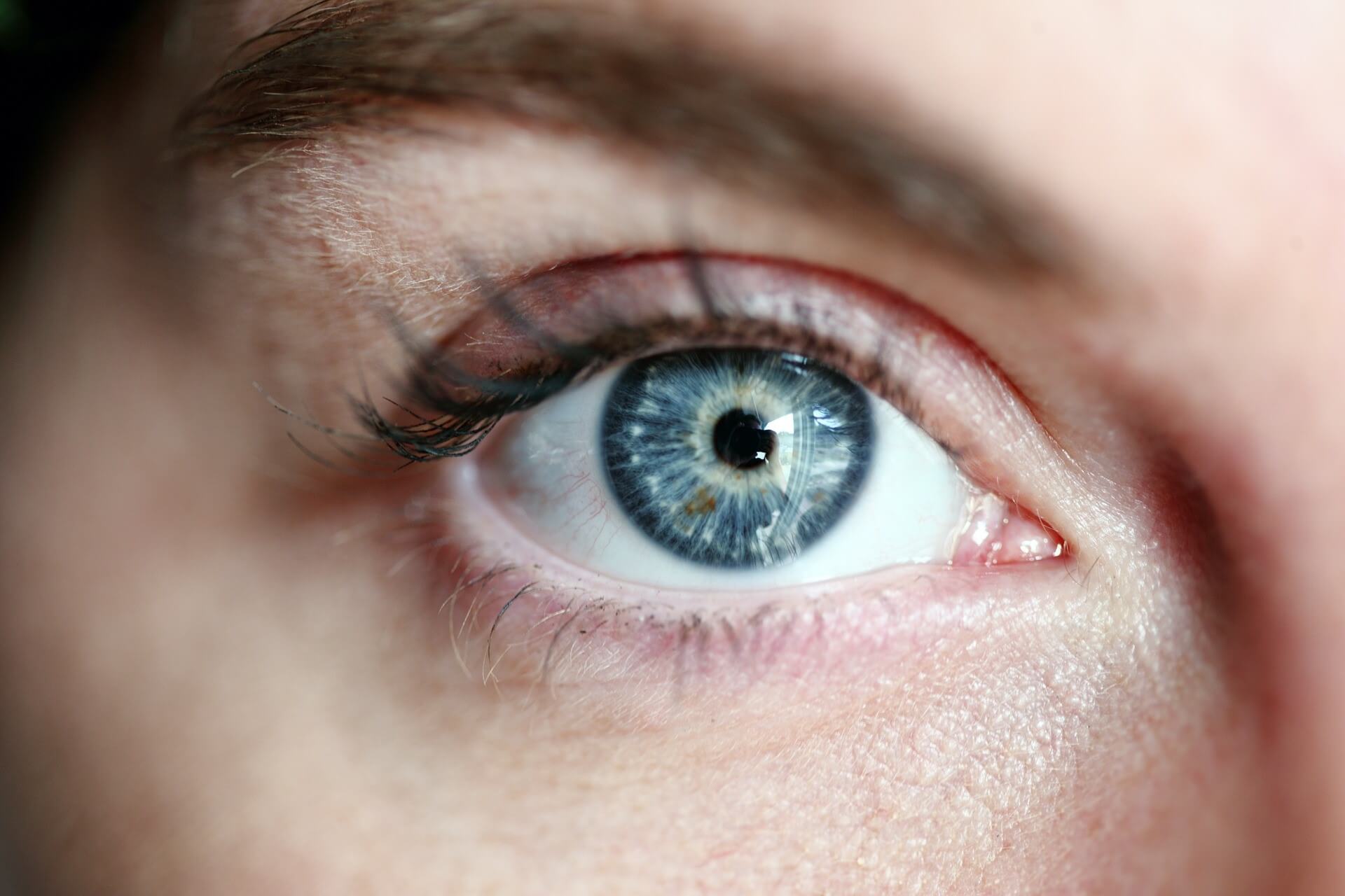 Issues Eye-Lift Surgery Can Solve
