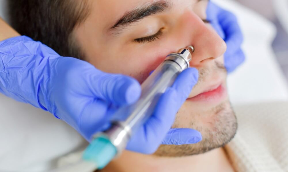 Are you an ideal candidate for male rhinoplasty?