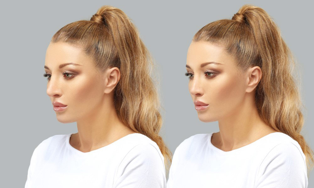 Follow the tips below to have seamless rhinoplasty surgery overseas.