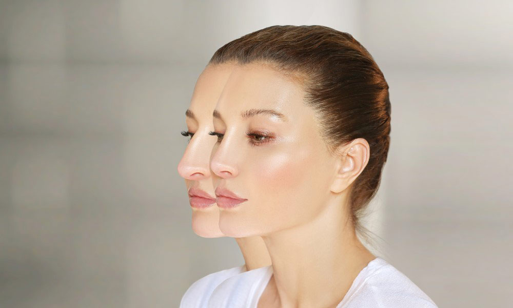 The cost of a nose procedure in the UK varies depending on many factors.